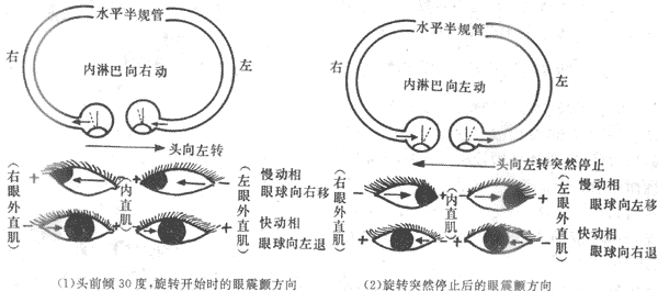 旋转变速运动时两侧水平半规管壶嵴毛细胞受刺激情况和眼震颤方向示意图