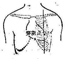 心穿刺点