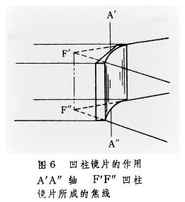 凹柱镜片的作用.JPG