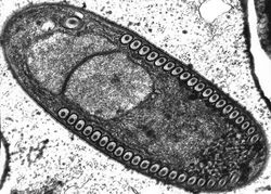 Fibri11anosema crangonycis（一种孢子虫）