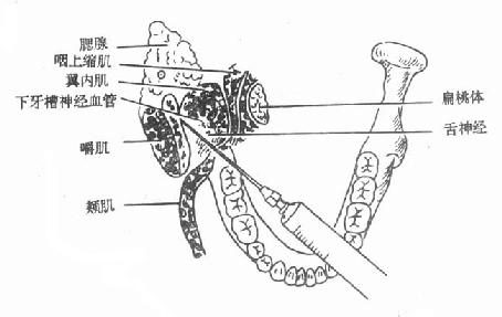 下牙槽神经阻滞麻醉部位的解剖关系