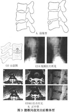 Gyr88cm2.jpg