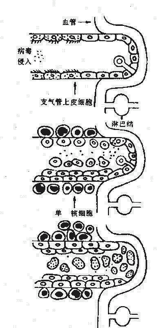 脊髓灰质炎病毒的全身感染（模式图）