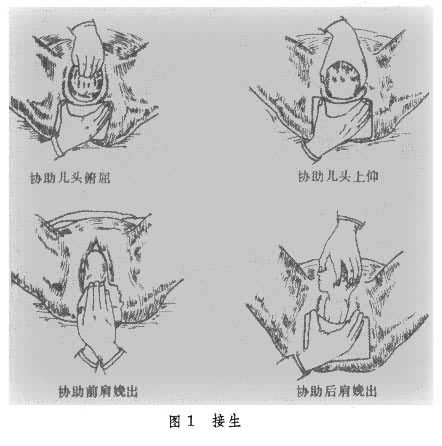 接生