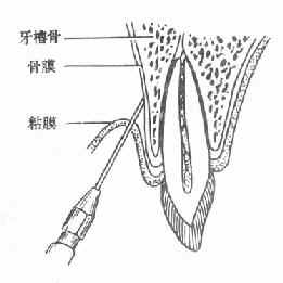 点击查看完整图片