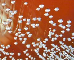 Burkholderia pseudomallei colonies on a blood agar plate.