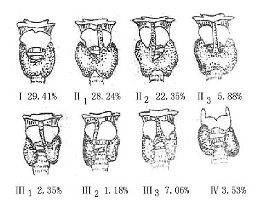 Glytajmq.jpg