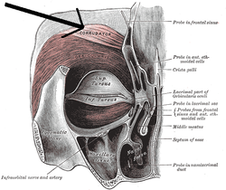 Musculuscorrugatorsupercilii.png