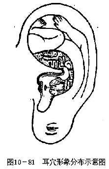 耳穴的分布示意图