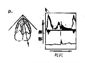 超声脉冲多普勒显示示意图