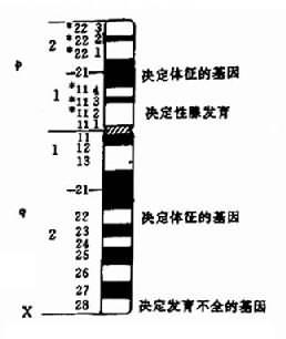 Turner综合征核型与症状相关图