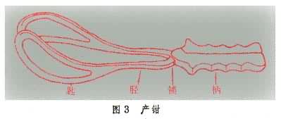 产钳