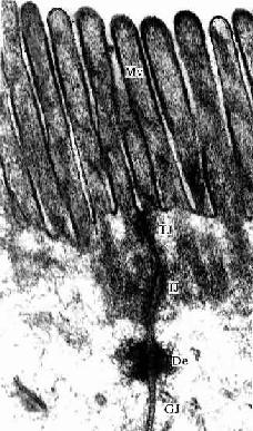 小鼠小肠上皮细胞电镜像