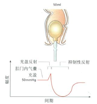 直肠气囊充盈引出的正常RAIR