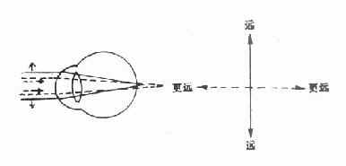 复性远视散光