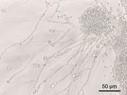 白色念珠菌 Candida albicans