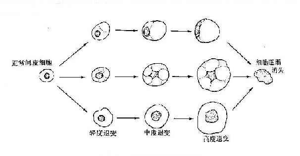 不同程度退变的间皮细胞